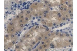 DAB staining on IHC-P; Samples: Rat Kidney Tissue (Biliverdin Reductase anticorps  (AA 10-279))