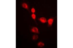 Immunofluorescent analysis of SMUG1 staining in HeLa cells. (SMUG1 anticorps  (Center))
