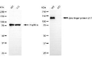 anti-Zinc Finger Protein 217 (ZNF217) antibody