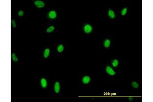 Image no. 1 for anti-N-Methylpurine-DNA Glycosylase (MPG) (AA 1-90) antibody (ABIN598819) (MPG anticorps  (AA 1-90))