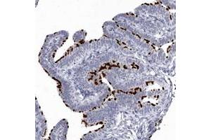 Immunohistochemical staining of human fallopian tube with C1orf114 polyclonal antibody  shows strong membranous positivity in glandular cells. (C1orf114 anticorps)