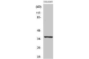 Western Blotting (WB) image for anti-Olfactory Receptor, Family 52, Subfamily E, Member 5 (OR52E5) (Internal Region) antibody (ABIN6281706)