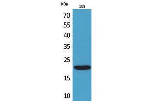 Western Blotting (WB) image for anti-CKLF-Like MARVEL Transmembrane Domain Containing 6 (CMTM6) (C-Term) antibody (ABIN3178338) (CMTM6 anticorps  (C-Term))