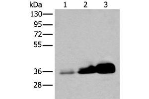 Western blot analysis of Human testis tissue NIH/3T3 and 231 cell lysates using UBE2Z Polyclonal Antibody at dilution of 1:350 (UBE2Z anticorps)