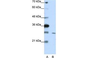Western Blotting (WB) image for anti-Zinc Finger Protein 397 (ZNF397) antibody (ABIN2461947) (ZNF397 anticorps)
