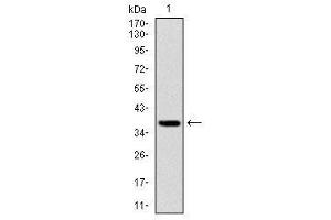 Image no. 3 for anti-Forkhead Box O1 (FOXO1) antibody (ABIN1498297)