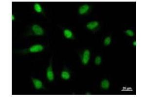 Immunostaining analysis in HeLa cells.