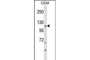 KIT Antibody (Ascites) ABIN1539990 western blot analysis in CEM cell line lysates (35 μg/lane). (KIT anticorps)