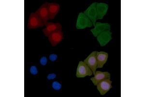 ABIN6258105 and ABIN6274888 staining Hela cells(45 min of heat-shock) by IF/ICC. (DDX19B anticorps  (N-Term))