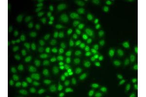 Immunofluorescence analysis of MCF-7 cell using PTPN6 antibody. (SHP1 anticorps  (AA 100-400))