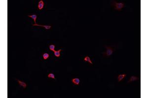 ABIN6268820 staining HeLa cells by IF/ICC. (HNRNPA2B1 anticorps  (N-Term))