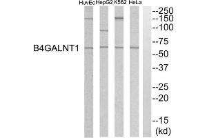 Western blot analysis of extracts from HeLa cells, K562 cells, HepG2 cells and HuvEC cells, using B4GALNT1 antibody. (B4GALNT1 anticorps  (Internal Region))