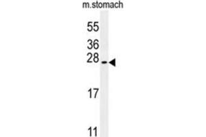Western Blotting (WB) image for anti-Dynein, Cytoplasmic 2, Heavy Chain 1 (DYNC2H1) antibody (ABIN3002490) (DYNC2H1 anticorps)