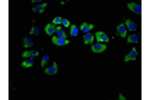 Immunofluorescence staining of A549 cells with ABIN7158410 at 1:66, counter-stained with DAPI.
