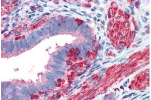 Human Uterus (formalin-fixed, paraffin-embedded) stained with ACTB antibody ABIN337261 at 5 ug/ml followed by biotinylated goat anti-rabbit IgG secondary antibody ABIN481713, alkaline phosphatase-streptavidin and chromogen. (beta Actin anticorps  (N-Term))