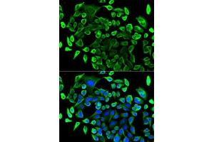 Immunofluorescence analysis of U2OS cells using T antibody (ABIN6131955, ABIN6148795, ABIN6148796 and ABIN6221421).