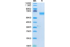 Human CD98 on Tris-Bis PAGE under reduced condition. (SLC3A2 Protein (AA 206-630) (His tag))