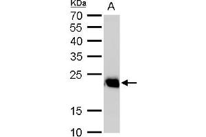WB Image RAB6A antibody detects RAB6A protein by western blot analysis. (RAB6A anticorps)