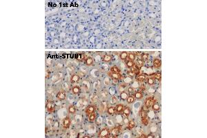 Immunohistochemistry (IHC) image for anti-STIP1 Homology and U-Box Containing Protein 1 (STUB1) antibody (ABIN6254206) (STUB1 anticorps)