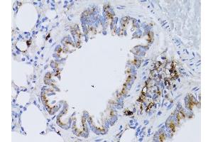Immunohistochemistry of paraffin-embedded rat lung using RARA antibody. (Retinoic Acid Receptor alpha anticorps)
