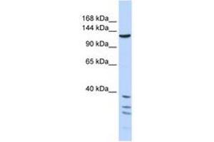 Image no. 1 for anti-Tankyrase, TRF1-Interacting Ankyrin-Related ADP-Ribose Polymerase (TNKS) (AA 1079-1128) antibody (ABIN6740351) (TNKS anticorps  (AA 1079-1128))