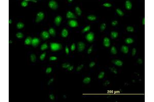 Immunofluorescence of monoclonal antibody to HDAC8 on HeLa cell.