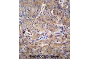 Immunohistochemistry (IHC) image for anti-Family with Sequence Similarity 212, Member B (FAM212B) antibody (ABIN2996391) (FAM212B anticorps)