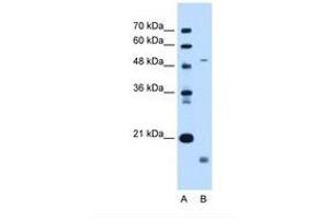 Image no. 1 for anti-Zinc Metalloproteinase, Ste24 (Zmpste24) (AA 83-132) antibody (ABIN6738260) (ZMPSTE24 anticorps  (AA 83-132))
