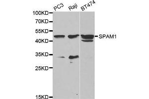 Western blot analysis of extracts of various cell lines, using SPAM1 antibody. (SPAM1 anticorps  (AA 100-300))