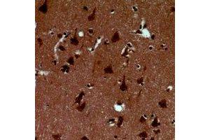 Immunohistochemical analysis of Alpha-synuclein (pY125) staining in human brain formalin fixed paraffin embedded tissue section. (SNCA anticorps  (C-Term, pTyr125))