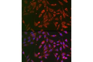 Immunofluorescence analysis of BALB-3T3 cells using TNFR1/TNFRSF1A Rabbit pAb (ABIN3022103, ABIN3022104, ABIN1513619 and ABIN6218606) at dilution of 1:100 (40x lens).