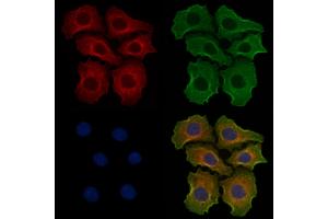 ABIN6256887 and ABIN6274764 staining Hela cells by IF/ICC.