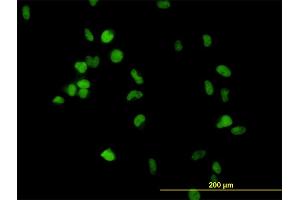 Immunofluorescence of monoclonal antibody to CSE1L on HeLa cell. (Exportin 2 anticorps  (AA 872-971))