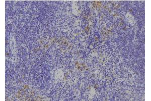 ABIN6268882 at 1/100 staining Human spleen tissue by IHC-P. (Fibronectin 1 anticorps  (C-Term))