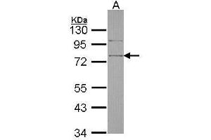 WB Image Sample (30 ug of whole cell lysate) A: Hela 10% SDS PAGE antibody diluted at 1:1000 (SRPX anticorps)