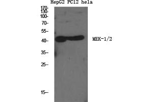 Western Blotting (WB) image for anti-Mitogen-Activated Protein Kinase Kinase 1/2 (MAP2K1/2) (Ser222), (Ser226) antibody (ABIN5961680) (MEK1/2 anticorps  (Ser222, Ser226))