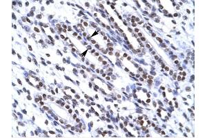 G22P1 antibody was used for immunohistochemistry at a concentration of 4-8 ug/ml to stain Epithelial cells of renal tubule (arrows) in Human Kidney. (XRCC6 anticorps  (N-Term))