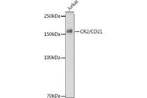 CD21 anticorps