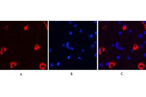 Immunofluorescence analysis of mouse brain tissue.