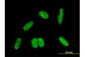 Immunofluorescence of purified MaxPab antibody to ZNF169 on HepG2 cell.