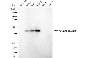 Western blotting analysis using creatine kinase B antibody (ABIN7798160). (CKB anticorps)