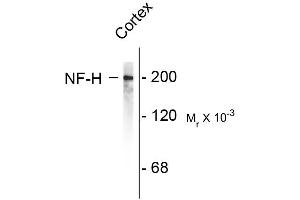 Western blots of rat cortex lysate showing specific immunolableing of the ~200k NF-H protein. (NEFH anticorps)