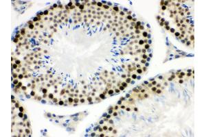 Anti- MNAT1 Picoband antibody, IHC(P) IHC(P): Mouse Testis Tissue