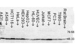 Western Blot analysis of Human Cell lysates showing detection of FKBP52 protein using Mouse Anti-FKBP52 Monoclonal Antibody, Clone Hi52C .