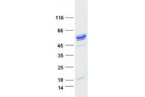 Validation with Western Blot
