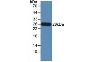 Detection of Recombinant GZMM, Human using Monoclonal Antibody to Granzyme M (GZMM) (GZMM anticorps  (AA 26-257))