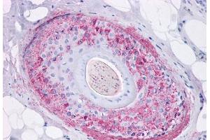 Anti-Ghrelin Receptor antibody  ABIN1048650 IHC staining of human skin, hair follicle.