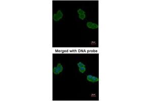 ICC/IF Image Immunofluorescence analysis of paraformaldehyde-fixed A431, using Aminoacylase-1, antibody at 1:200 dilution. (Aminoacylase 1 anticorps)