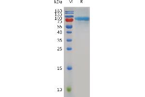 Mouse Q Protein, His Tag on SDS-PAGE under reducing condition.