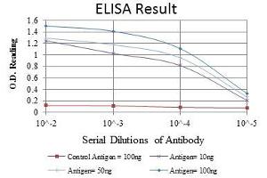 Red: Control Antigen (100 ng), Purple: Antigen (10 ng), Green: Antigen (50 ng), Blue: Antigen (100 ng), (CDK9 anticorps)